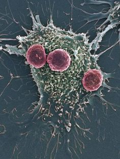 Coloured scanning electron micrograph (SEM) of T lymphocyte cells (red) attached to a cancer cell Scanning Electron Micrograph, Immune Cells, New Scientist, T Cell, Science Photos, The Future Is Now, Skin Tissue, Blood Cells, Microbiology