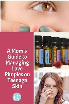 As a teen mom, managing love pimples on teenage skin can be a daunting task. From choosing the right cleansers and creams to navigating the ever changing hormones of adolescence, it’s important to have the right resources and knowledge at hand to help tackle these love pimples head-on. Oily Face, Types Of Acne, Heavy Makeup, Mild Cleanser, Oil Free Moisturizers, Teen Mom, Wash Your Face, Skin Concern