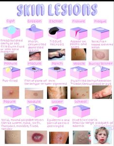 the different types of skins and how they are used to treat them for treatment