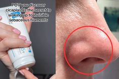 La Roche Posay Cicaplast: Black spots nose hack. Nose Pores, Dermatological Skin Care, Beauty Remedies, Roche Posay, Beauty Ideas, La Roche Posay, Face Skin Care, Skin Tips, Health And Beauty Tips