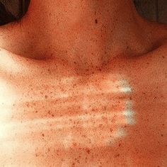 the back of a man with freckles on his chest