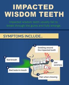 Learn more about wisdom teeth and the types of impacted teeth from Oakland Oral Surgery & Dental Implant Center in Michigan. Bad Taste In Mouth, Impacted Wisdom Teeth, After Wisdom Teeth Removal, Dental Wallpaper, Impacted Tooth, Preventive Dentistry, Sensitive Teeth Remedy, Wisdom Tooth Extraction, Wisdom Tooth