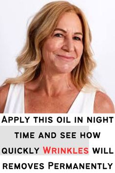 If you want to get rid of the wrinkles successfully then you need to follow natural remedies these are great ways to prevent wrinkles at home#wrinkles #skincare #skincaretips #beauty #beautytips Diy Facial Moisturizer, Wrinkles Remedies Face, Anti Aging Skincare Routine, Erase Wrinkles, Diy Anti Aging, Glow Skin, Wrinkled Skin