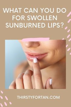 What Can You Do for Swollen Sunburned Lips? In this article, I'm going to tell you 3 home remedies that can help heal your lips.