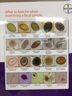 the poster shows what to look for when examining a fecal sample