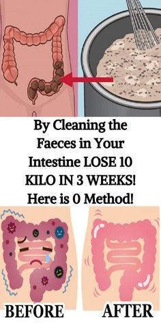 By Cleaning the Faeces in Your Intestine LOSE 10 KILO IN 3 WEEKS! Here is 0 Method! 3 Weeks