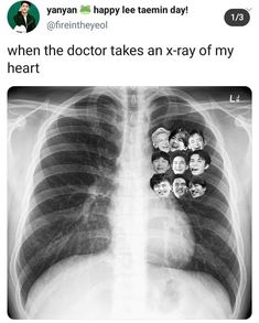 an x - ray image with the caption that reads, when the doctor takes an x - ray of my heart