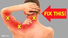 Nerve Pain Remedies, Dr Rowe, Neck Pain Exercises, Forward Head Posture Exercises, Pain Relief Remedies, Pinched Nerve, Shoulder Pain Relief