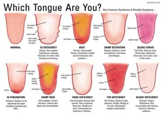 Ever have the Dr. check your tongue? Ever wonder why? Now you know. The tongue is the first indication of something wrong in the body! Body Hacks, Natural Medicine, Acupressure