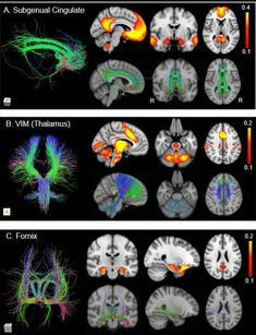 the different areas of the human brain are shown in this image, and there is no image