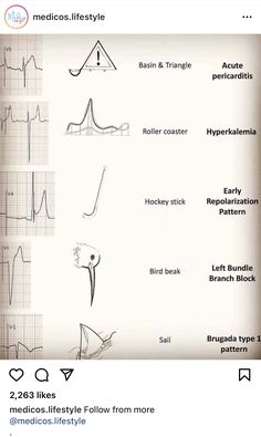 an image of different medical diagrams on the screen, with caption in english and spanish