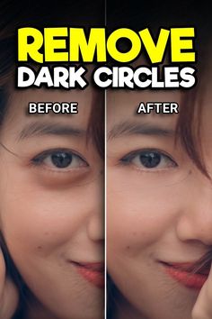 the before and after image shows how to remove dark circles