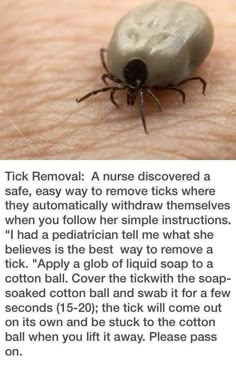 Lou Dog, 1000 Lifehacks, Tick Removal, Tick Repellent, Camping Checklist, Simple Life Hacks, Diy Life Hacks, Survival Tips, Useful Life Hacks