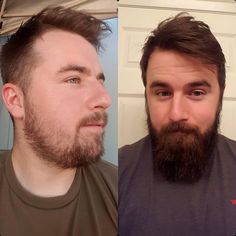 Yeard Beard, Beard Before And After, Beard Rules, Full Beard, Beard Growth, Beard Oil, Beard Styles, Hair Transformation