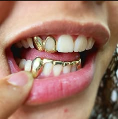 Showing Off Grills Teeth, Gold Tooth Aesthetic, Women Gold Teeth, Women With Gold Teeth, Girls Grills Teeth, Bottom Row Grillz, Bottom Grills For Women Gold, Partial Teeth Grills