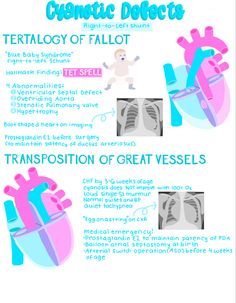 an info sheet describing the different types of heart valves