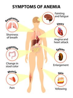 Always Tired, Shortness Of Breath, Healthy Smoothie, Natural Home Remedies, Vitamin D, Migraine, Health Problems