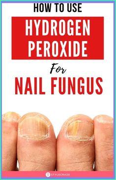 Hydrogen Peroxide Cures Nail Fungus – Step by Step Guide Healing Water, Healing Waters, Nail Care Tips, Hair Removal Cream, Strong Nails