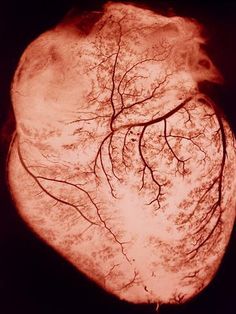 an image of the inside of a heart with trees on it's sides and branches in the center