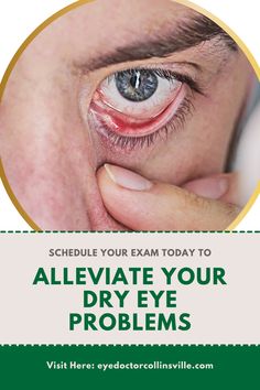 Article talking about the different things you can do to help alleviate your dry eye problems Eye Strain Relief, Dry Eyes Causes, Increase Height Exercise, Eye Problems, Sense Of Sight, Dry Eye