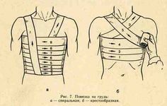 an old drawing shows how to wrap the back