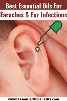 Earaches and Ear Infections: A Guide to the Essential Oils, Recipes and Home Remedies That Soothe Sore Ears Doterra Oils For Earache, Earache Essential Oils, Essential Oils Ear Ache, Homeopathic Ear Ache Remedy, Ear Ache Essential Oils, Essential Oils For Ears, Eo For Earache, Homeopathy For Ear Infections, Essential Oil Earache Relief