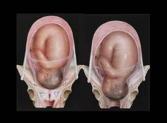 an image of a baby in the middle of its diaper and on top of it's head