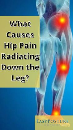 Lower Leg Pain, Nerve Pain Remedies, Sciatic Nerve Pain Relief, Bursitis Hip, Sciatica Pain Relief, Foot Pain Relief