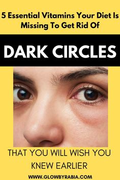 Vitamin deficiencies can lead to dark circles, So what foods should we eat to get rid of dark circles naturally ? Here we will recommend 5 vitamins that can reduce the appearance of dark circles by counteracting the vitamin deficiencies causing them Under eye dark circles| Remedies for dark circles| under eye bags| How to clear dark circles overnight| Under eye bag remedies| dark circles around the eyes| how to remove dark circles under eyes permanently| vitamins for dark circles Dark Rings Under Eyes, Remove Eye Wrinkles, Eye Bag Remedies, Dark Circle Remedies, Under Eye Fillers, Sunken Eyes, Green Tea Face, Eye Skin Care, Remove Dark Circles