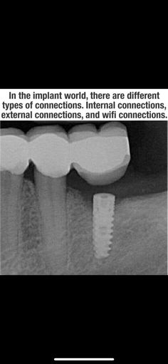 Dental Pictures, Dental Fun, Dental Technician, Pharmacology Nursing