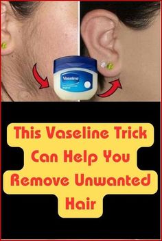 This Vaseline Trick Can Help You Remove Unwanted Hair Best Permanent Hair Removal, Brazilian Hair Removal, Permanent Hair Removal Cream, Chin Hair Removal, Permanent Facial Hair Removal, Back Hair Removal, Electrolysis Hair Removal, Lip Hair Removal, Ingrown Hair Removal