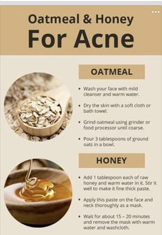 Oatmeal Facial Mask, Diy Face Mask For Acne, Diy Exfoliating Face Scrub, Oats Face Mask, Diy Acne Mask, Oatmeal Face Mask, Face Mask For Acne, Mask For Acne