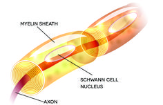 Myelin sheaths are insulating layers that surround the nerves. Made up of protein and fatty tissue, the sheath enhances and speeds up electrical impulses throughout the body. Together with the brain and spinal cord, nerves send and transmit signals that control virtually every function in the body.When it comes to ... Multiple Sclerosis Diet, Nerve Repair, Myelin Sheath, Nerve Disorders, Nerve Health, Nerve Cell, Nerve Damage, Thyroid Hormone, Thyroid Health