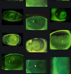 several images of the inside of an eye with green light coming from it's iris