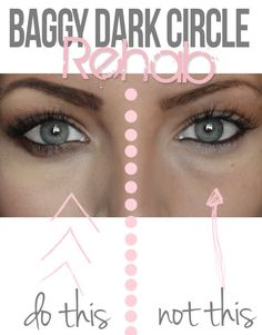 Damage control: The absolute BEST way to diminish baggy under eyes and dark circles. Baggy Eyes, Under Eyes, Dark Under Eye, Dark Circle, Creamy Concealer, Undereye Circles, Face Scrub, Makeup Collection