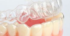 Cheap Invisalign Braces Dental Education, Misaligned Teeth, Clear Aligners, Teeth Straightening, Emergency Dentist