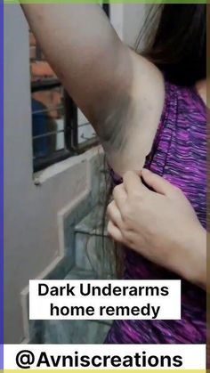 😱Dark Underarms home remedy/Underarms Darkness kese htaye #viral #shorts #ytshorts #avniscreations How To Get Rid Of Dark Underarms Fast, Remove Dark Underarms Fast, Home Remedies For Dark Underarms, Dark Underarms Home Remedies, Diy For Dark Underarms, How To Brighten Underarms, Underarm Darkness Remedies, How To Clean Underarms, Armpit Lightening