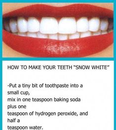 Diy Teeth, Healthy Board, Get Whiter Teeth, Laser Teeth Whitening