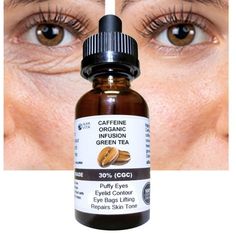 CAFFEINE 30% INFUSION & GREEN TEA Bags Under Eyes Reducer Organic Serum Bottle Dropper 1 fl oz (30 ml) CAFFEINE BENEFITS: Caffeine is soothing and can reduce under-eye bags. Caffeine is an antioxidant and can help protect against damage and keep your eye area looking its best. PRODUCT MADE IN USA Caffeine premium organic coffee concentrate (30%), cosmetic grade, green tea beans, liquid silica & vegan glycerin. (KEEP IT REFRIGERATED AFTER OPENED). Our products are made with the best quality ingre How To Fix Under Eye Bags, Puffy Under Eyes Bags, Under Eye Bags Remedies, Caffeine Benefits, Eye Bags Makeup, Wrinkles On Face, Clear Skin Remedies, Puffy Eyes Remedy, Baggy Eyes