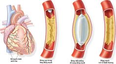 an image of the heart and its valves showing different stages of blood flow through it