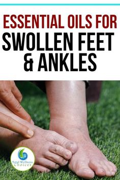 Essential Oil For Swelling, Natural Healing Remedies, Diy Remedies, Cold Home Remedies, Natural Therapy, Natural Diy, Best Essential Oils, Natural Health Remedies, Natural Home Remedies