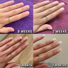 Nail Growth Oil – Radiant Cosmetics Nails Healthy Tips, Castor Oil For Nail Growth, Nail Growth Oil, Nail Conditions, Natural Nail Care, Gel Acrylic Nails, Broken Nails, Nail Care Tips, Brittle Nails