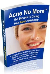 Acne No More Best Face Wash For Acne, Face Wash For Acne, The Best Face Wash, Comforting Words, Greasy Skin, Acne Vulgaris, Bad Diet, Get Rid Of Acne, Best Face Wash