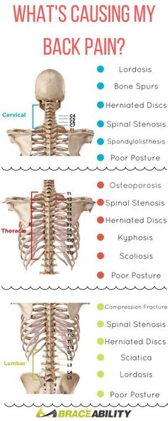 Exercises For Lower Back Lumbar Lordosis, Pain Chart, Middle Back Pain, Upper Back Pain, Lower Back Exercises