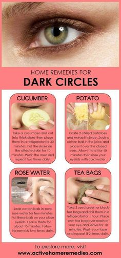 Remedies For Dark Circles, Fitness Corner, Pineapple Health Benefits, Dark Circle Remedies, Face Time, Remove Dark Circles