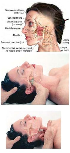 Massage Therapy ..........TMJ syndrome can be relieved through examination and treatment of the lateral and medial of the pterygoid muscles.......The Pterygoids are jaw (temporomandibular joint, or TMJ) muscles that radiate in a winglike pattern .....Kur ♥ Punkty Spustowe, Tmj Relief, Facial Anatomy, Reflexology Massage, Therapeutic Massage, Massage Techniques, Massage Therapist