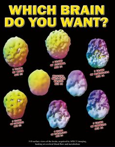 a poster with the words which brain do you want?