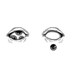 an eye is shown with two different parts in the iris's eyes, and one has