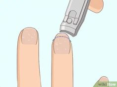 Peeling Fingernails, Nail Remedies, Nails After Acrylics, Split Nails, Washing Your Hands, Peeling Nails, No Chip Nails, How To Cut Nails