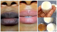 Lighten Lips, Lighten Dark Lips, Diy Lip Scrub, Lip Lightening, Lip Scrub Recipe, Natural Remedies For Migraines, Lip Scrub Homemade, Lip Scrub Diy